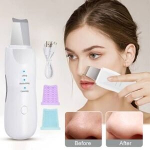 Ultrasonic Skin Scrubber & Facial Pore Cleanser